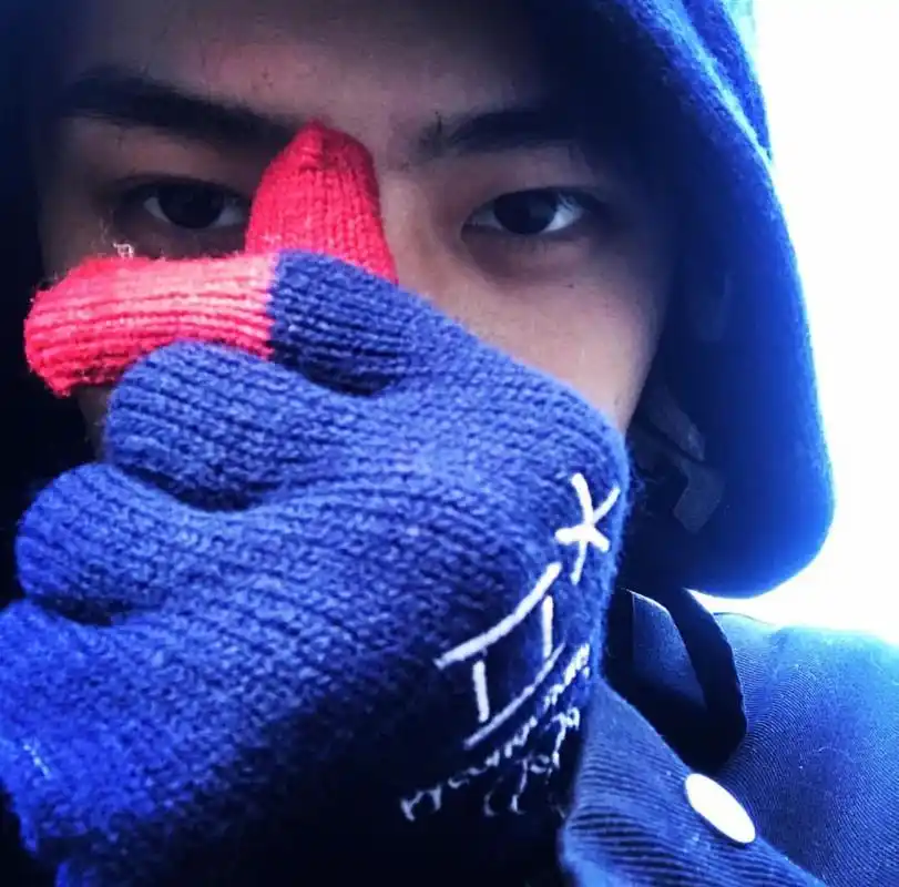 原来exo吴世勋自拍照是这样来的!怪不得这么丑,粉丝直呼好心塞