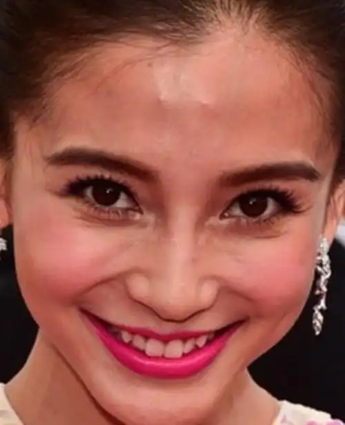 满脸痘,肚子大,皮肤黑!6位生图里的明星,让我看见了人间真实