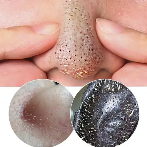 去黑头祛粉刺讽刺面膜撕拉式鼻子脸部粘吸拔白头除螨虫鼻膜膏男.