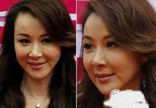 女星整容过度脸歪僵硬,微微一笑超尴尬