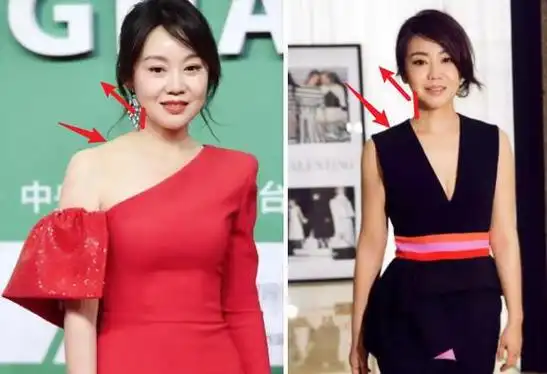 下面这两张是闫妮不同时期的照片,前一张有点轻微的含胸驼背,看起来就