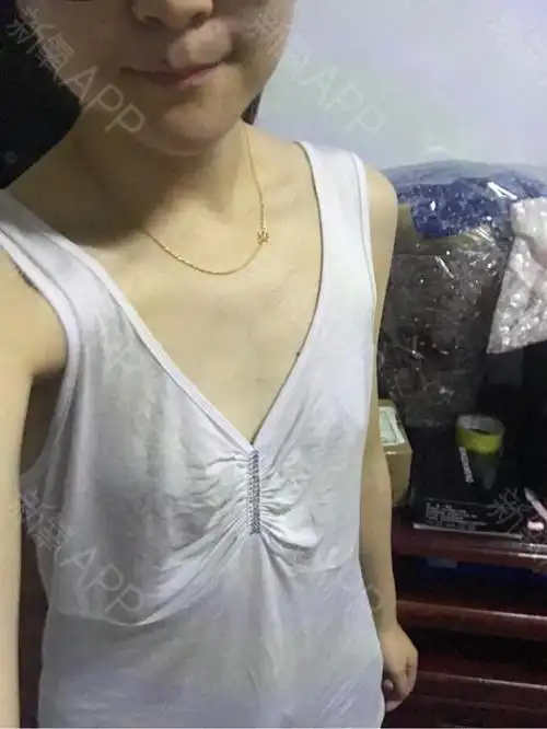自己的胸部很平每次都很自卑,买内衣最小号都撑不起来_圈子-新氧美容