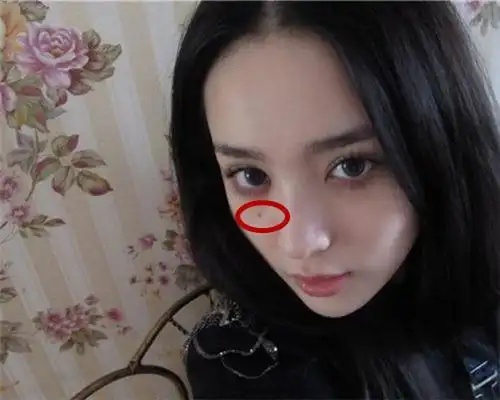 人身上有哪几个地方的痣被称为苦情痣