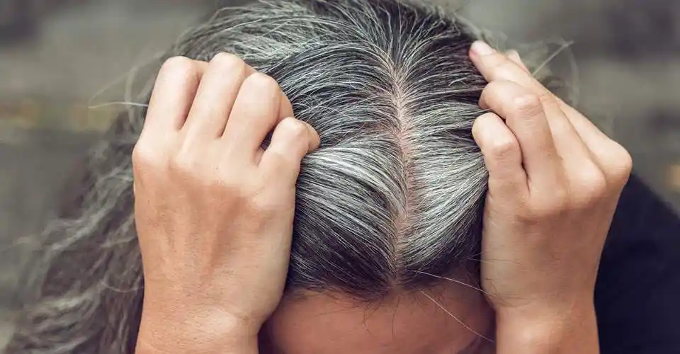 青壮年突生白发是压力太大了吗