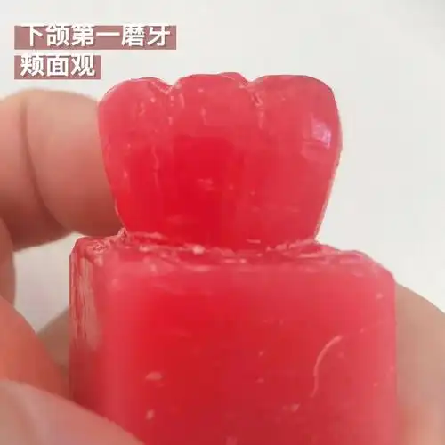 口腔解剖生理学雕牙下颌第一磨牙