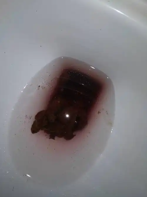 昨天午饭吃了猪血,,到今早却排出了黑便便而且有点