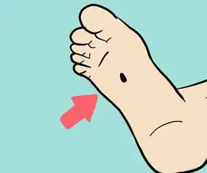 女人哪里长痣好?预示财多福多又旺夫的吉痣,你有吗?