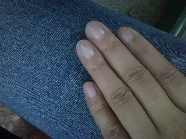 我的指甲为什么是发紫的,好像有几年了,不过身体很健康