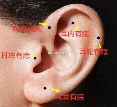耳朵上的痣相小知识,对照看看你耳朵上有没有富贵痣