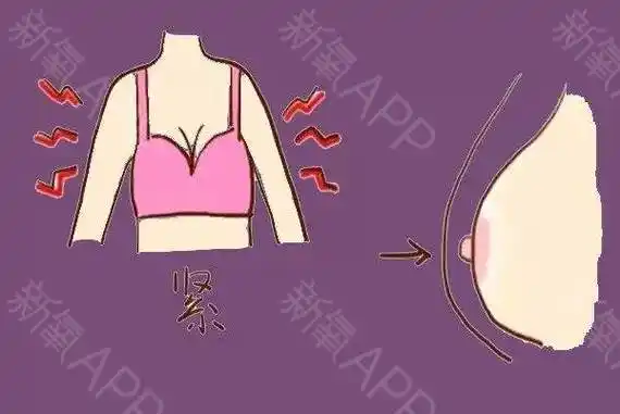 乳头内陷可别拽,拽也拽不出来!