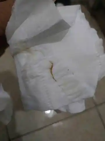 怀孕七周有这褐色分泌物正常吗