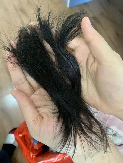 出征前的她们都曾满头秀发 内镜中心的常琳把头发剪成符合标准的发型