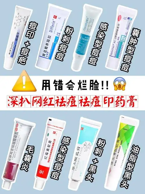 最红祛痘药膏评测你真的用对了吗