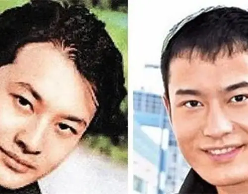 【图】黄晓明整容前后照片对比照 "肉脸照"曝光