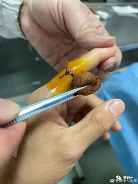 举着血淋淋的手指求助!