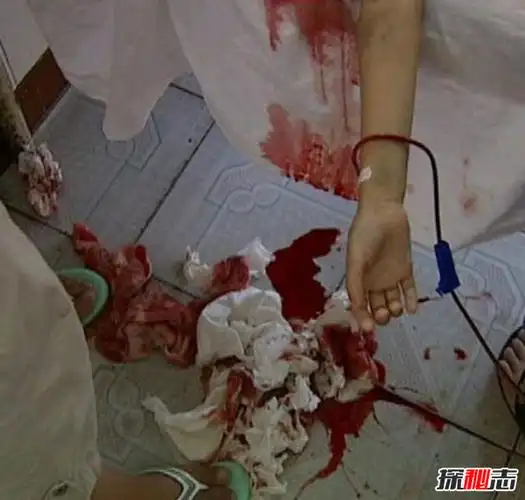 小苏丽验尸照片(死后遭亲生母亲扒坟)