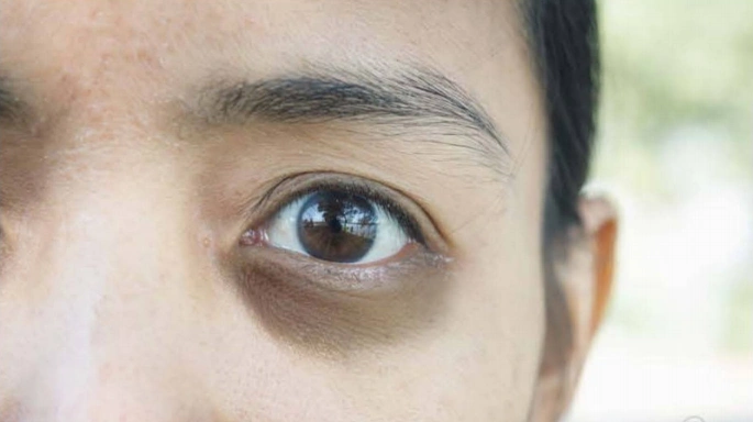 长期熬夜的皮肤护理方法:基本保湿 美白抗氧化精华