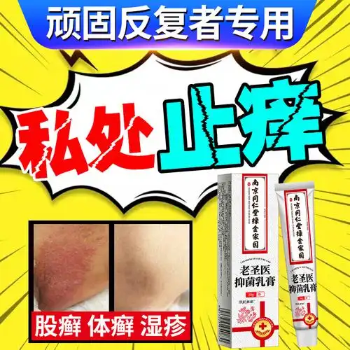 股癣大腿内侧专用药膏真菌感染屁股湿疹止痒去阴囊根私处瘙痒男女