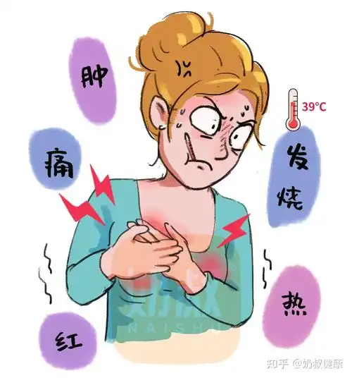 产后涨奶堵奶热敷or冷敷做错乳房太受伤