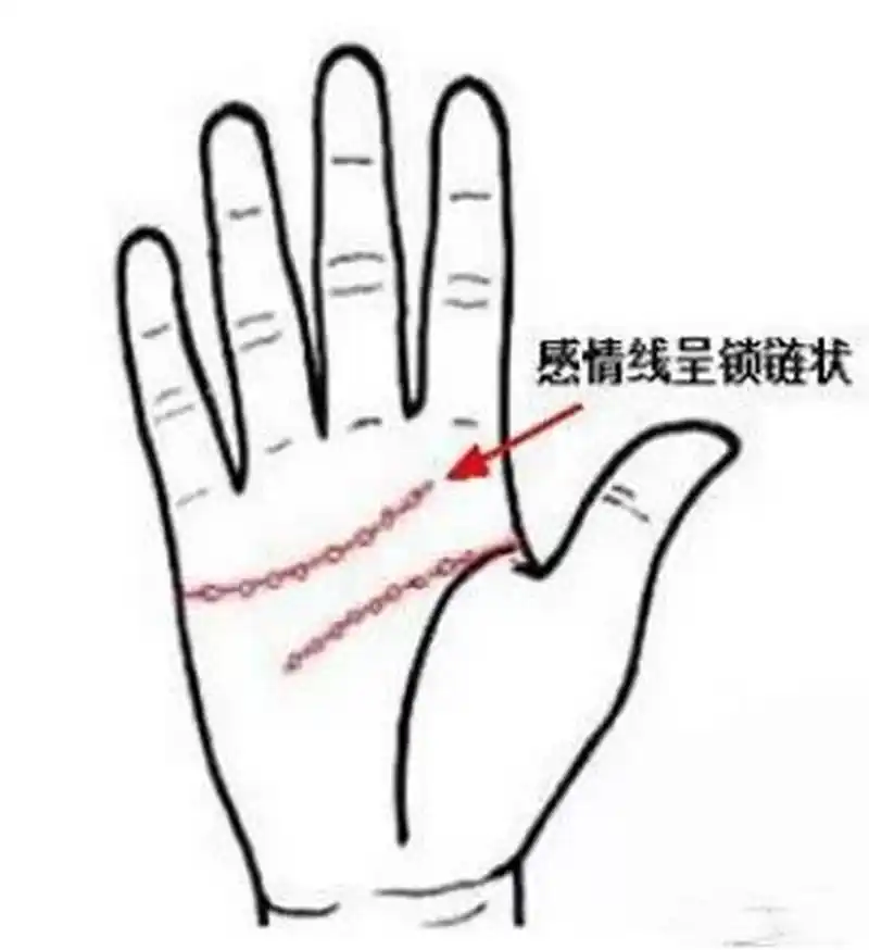 两只手都是属于川字纹的手相,同时感情线上有岛纹