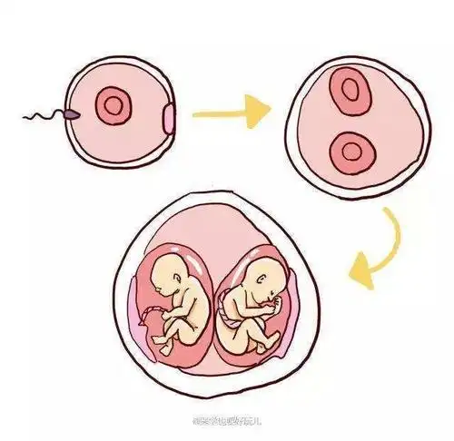 如果你被确定为单绒毛膜双胎,那么意味着你怀的是一对同卵双胞胎.