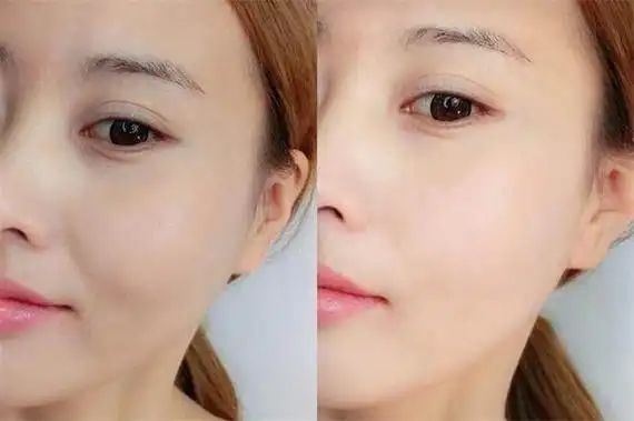 皮肤暗黄用什么牌子护肤品效果好美白去暗黄护肤品排行榜