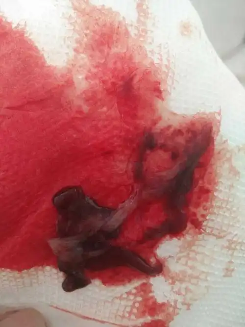 不知道怎么了,流出这样的东西