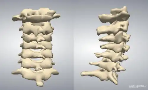 梗着脖子工作和玩游戏会带来哪些伤害?