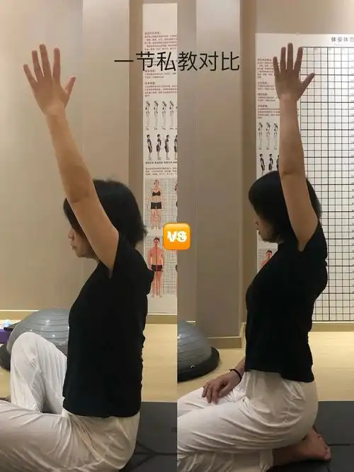 经过评估下斜方无力,肩胛提肌缩短,导致肩胛骨上移,斜方肌显得肥厚