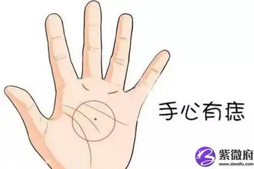 手心长痣意味着什么