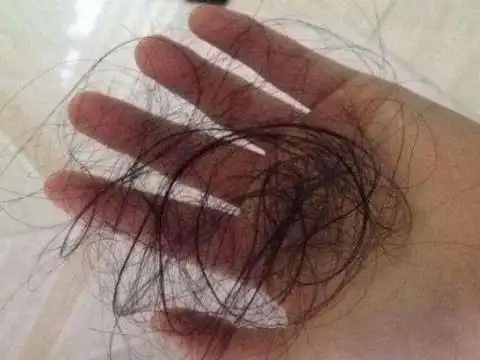 梦见头发稀疏快秃了