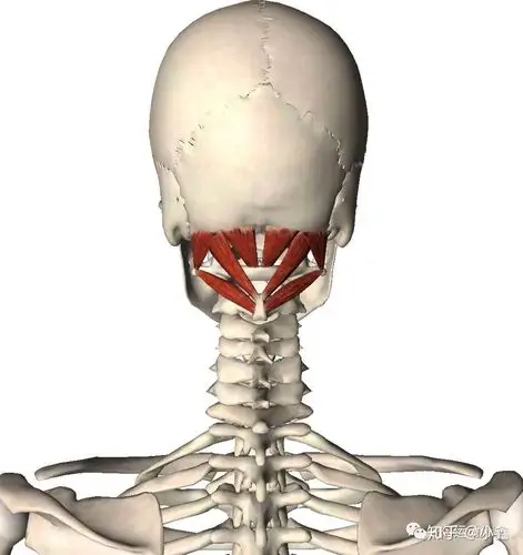 头颈部疼痛之颈后肌群多裂肌回旋肌枕下肌群触发点疗法