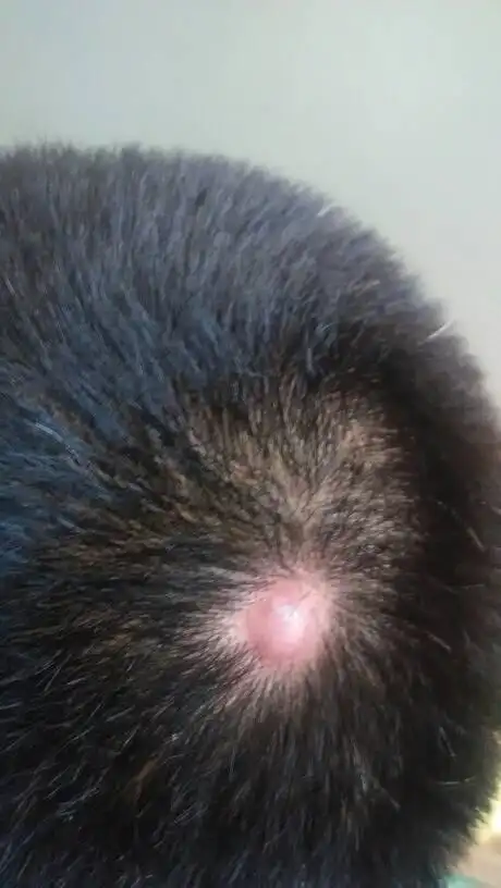 头上长了一个脓包,破了好几次,都是血脓,但是每次又还会再长起来!