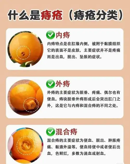 痔疮咱老百姓有验方和外洗方