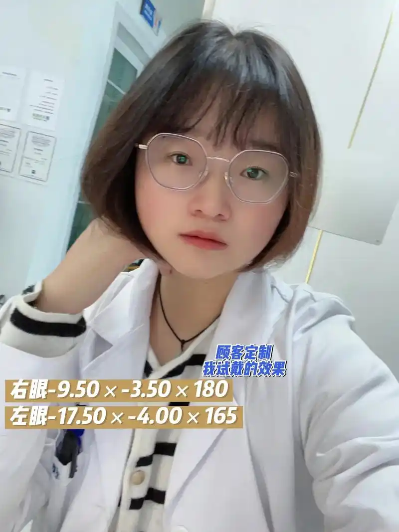 超高度近视 严重屈光参差的眼镜上脸效果.右眼-9.50×-3 - 抖音