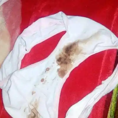 怀孕到现在早上突然发现内裤上血迹斑斑的,怎麼回事呀各位宝妈