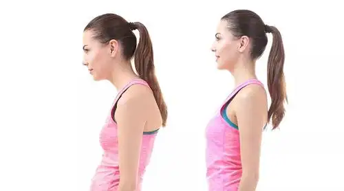 脖子前倾毁了无数人,明星都逃不过!3 个动作拯救气质