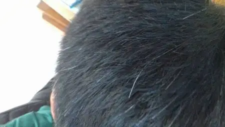 我16岁,头后面已经有很多白头发了.