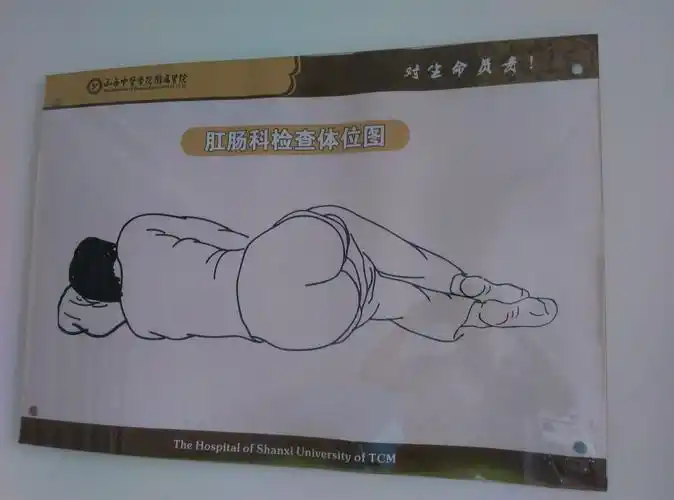 30活动期间,患者可免费检查(约八十元,含一次性无菌肛门镜和肛门终镲