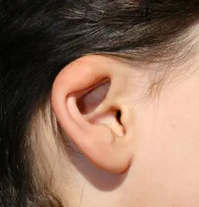 耳廓畸形发展.整形外科和美容照片