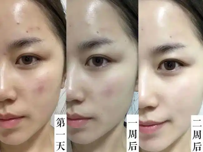 美白成分对比图 真人实测 效果因人而异