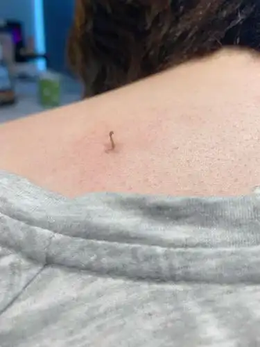 身上有个黑洞!隔几个月就能挤超长黑头!我可真是个宝藏女孩