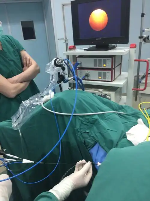 983医院泌尿外科—输尿管软镜碎石