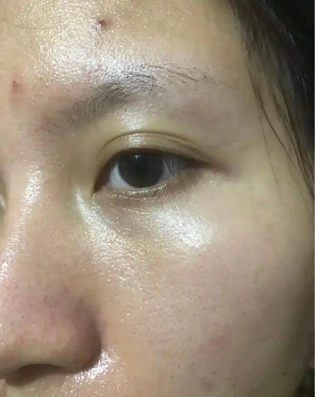 夏季皮肤频繁出油?先自查这几个原因,好皮肤自然会养成!