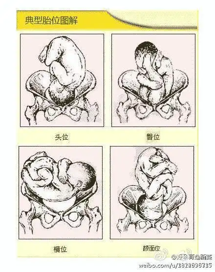 胎位示意图(转)