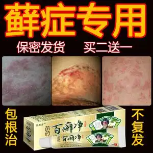 百癣净止痒药膏股藓专用皮炎皮肤外用瘙痒抑菌湿疹去根私处手足癣