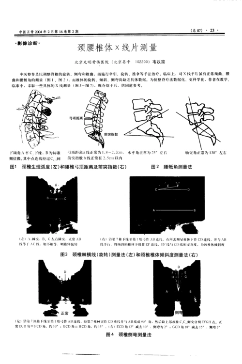 颈腰椎体x线片测量
