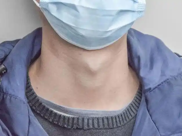 女孩的喉结男孩的胸太大了好像都不行