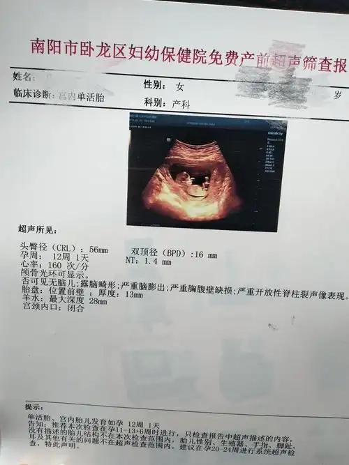 nt怎么看男孩还是女孩