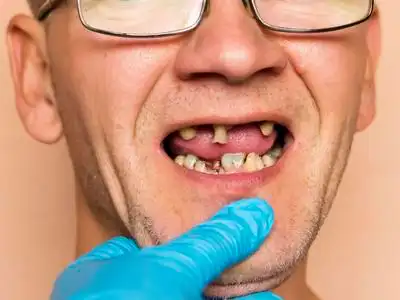 丢失的手杖的卡通小老头白种人 后果 幸福 面对 男人 牙医 微笑 牙齿